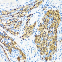 KMT2E antibody