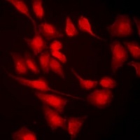 Anti-MLL5 Antibody