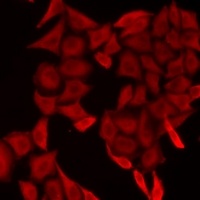 Anti-SMYD5 Antibody