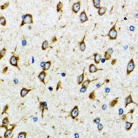 Anti-AKTIP Antibody