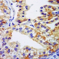 Anti-TSSC3 Antibody