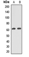 CAF-I p60 Antibody