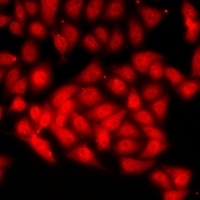 Anti-CAF-I p60 Antibody