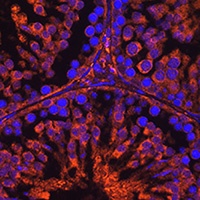 Anti-LH Receptor Antibody