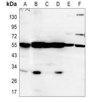 BNIP3L Antibody