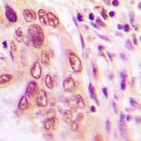 Anti-BNIP3L Antibody