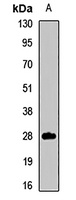 CD231 Rabbit Polyclonal Antibody