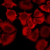Anti-CD231 Antibody