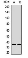 LYVE-1 Rabbit Polyclonal Antibody