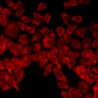 Anti-UCN2 Antibody