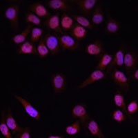 Anti-PRDM14 Antibody