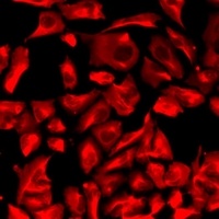 Anti-LPAAT beta Antibody