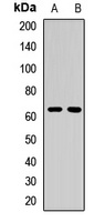 ALAS-E Rabbit Polyclonal Antibody