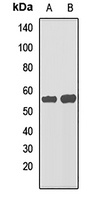 MISR2 Rabbit Polyclonal Antibody