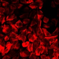 Anti-BLMH Antibody