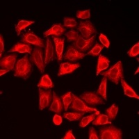 Anti-CALU Antibody