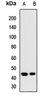 CD207 Rabbit Polyclonal Antibody