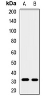GNMT Rabbit Polyclonal Antibody