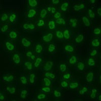 Anti-SLM2 Antibody