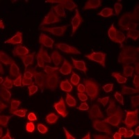 Anti-LECT1 Antibody