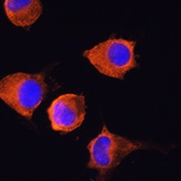 Anti-CD228 Antibody