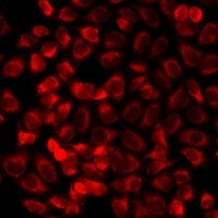 Anti-RAMP3 Antibody