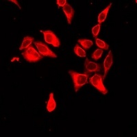 Anti-NPT2 Antibody
