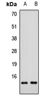 SMPX Antibody