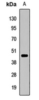 SPDEF Rabbit Polyclonal Antibody