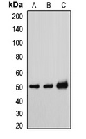 TAT Rabbit Polyclonal Antibody