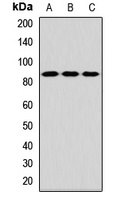 TLK2 Rabbit Polyclonal Antibody