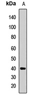 FANCL Rabbit Polyclonal Antibody