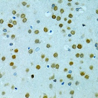 Anti-MUS81 Antibody