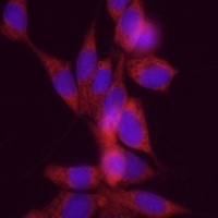 Anti-DGAT1 Antibody