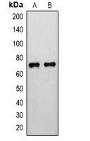 15-LO Rabbit Polyclonal Antibody