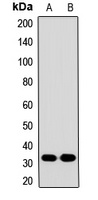 CAC Rabbit Polyclonal Antibody
