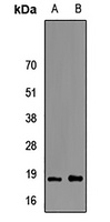 FABP6 Antibody