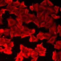 Anti-FABP6 Antibody