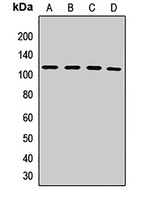 PMS2 Rabbit Polyclonal Antibody
