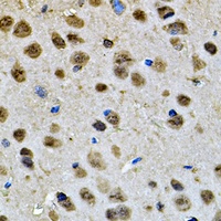 Anti-Cyclophilin D Antibody