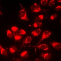 Anti-Serglycin Antibody