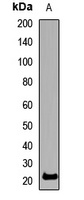 SSX2 Rabbit Polyclonal Antibody