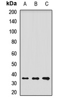Laforin Rabbit Polyclonal Antibody
