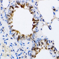 NAA10 antibody