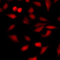 Anti-ARD1 Antibody