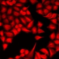 Anti-DYRK2 Antibody