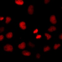 Anti-HIRIP3 Antibody