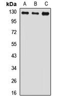 USP8 Antibody