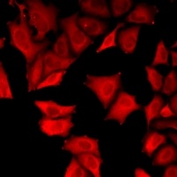 Anti-USP8 Antibody