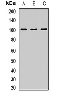 DDX21 Rabbit Polyclonal Antibody